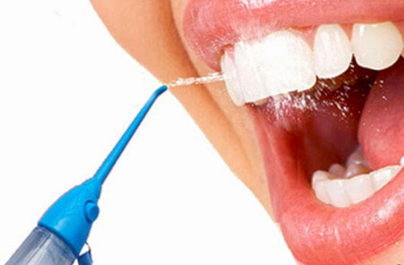 Por qué deberías cambiar a un irrigador dental?