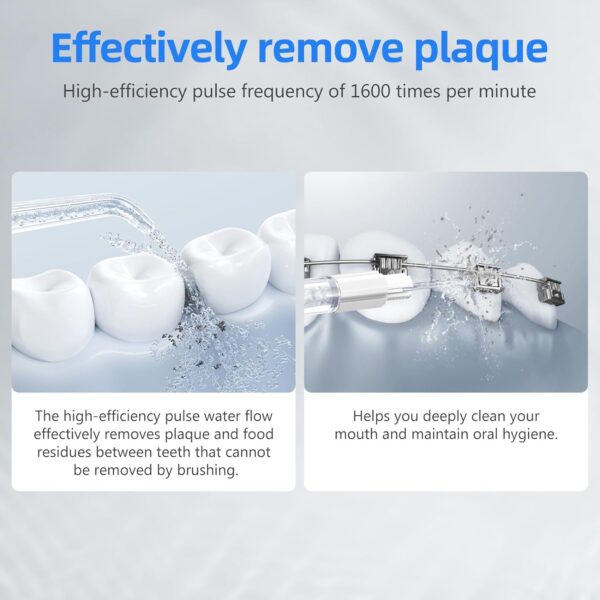Apiker Irrigador Bucal Portatil con 2 Boquillas,Irrigador Dental Portatil 250ML,Irrigador - Imagen 5