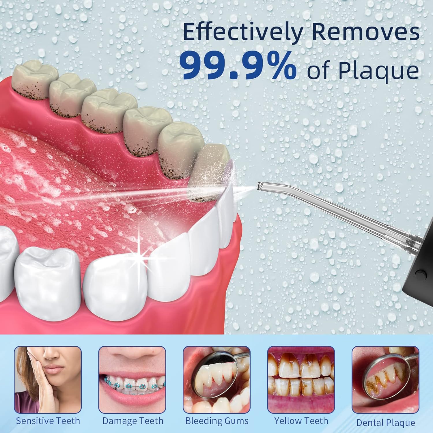 GEEDIAR Irrigador Dental, IPX7 Impermeable Irrigador Bucale con 6 Boquillas,190ml - Imagen 2